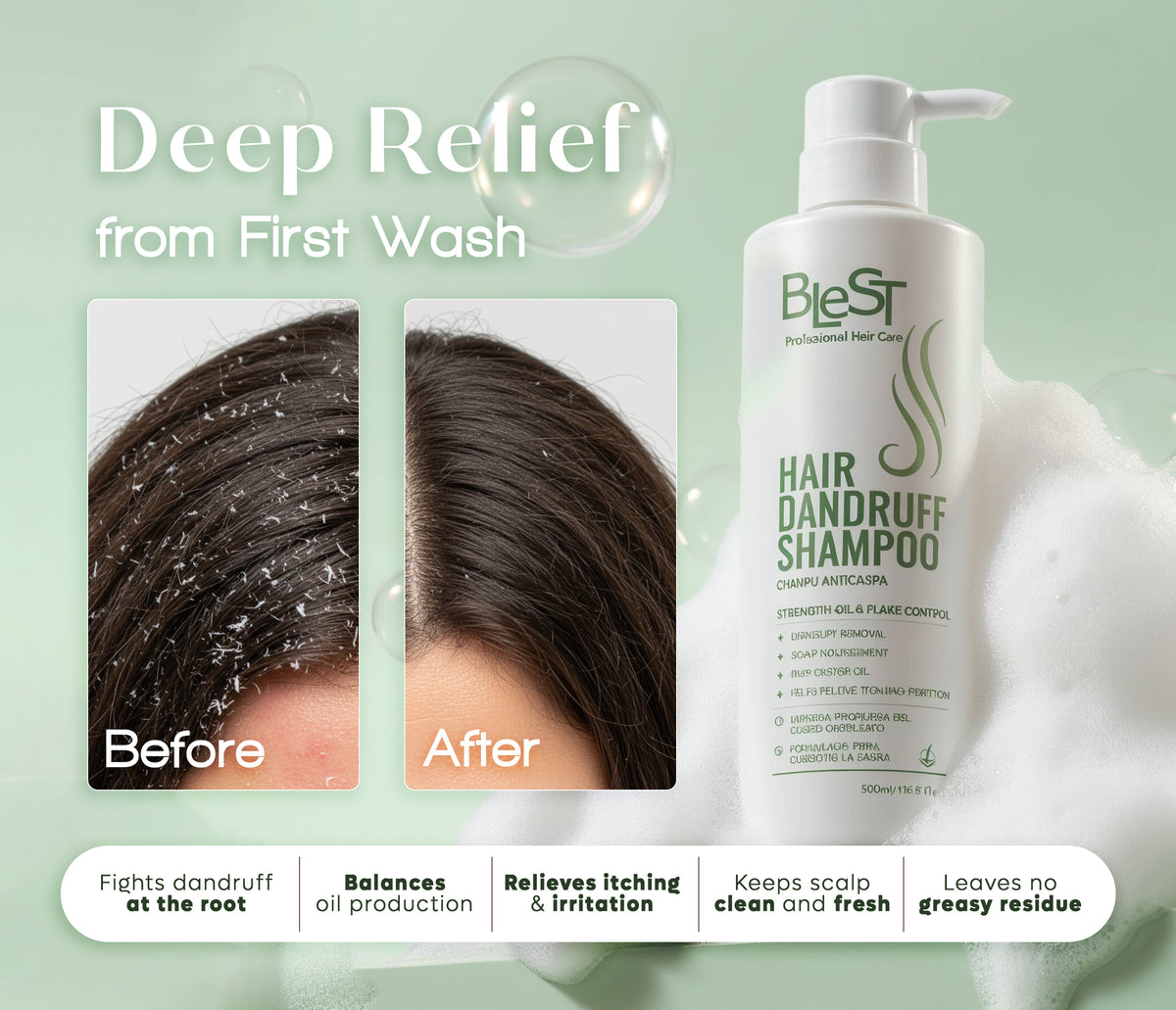 BLEST Anti-Dandruff Shampoo – Scalp Cleansing